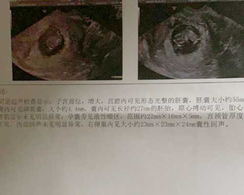 上海计生所医院：上海做试管孕的医院,上海不孕不育医院排名是怎样的？
