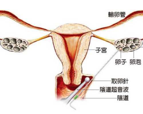 上海代孕服务质量好,上海助孕公司有哪些，上海哪里可以做试管