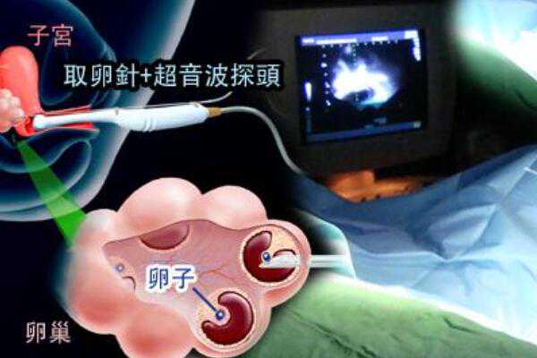 上海供卵医院鑫坤和助孕,上海哪些医院可以进行三代试管技术操作？?,2023年在