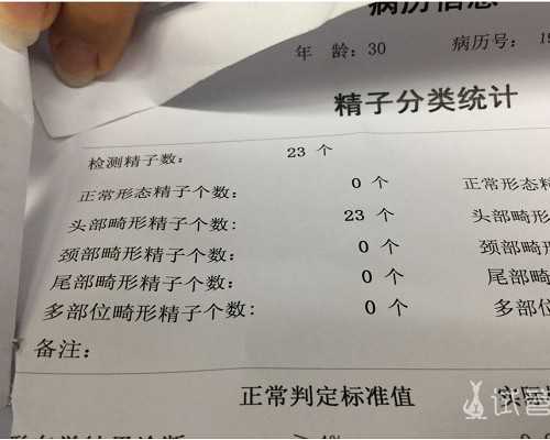 备孕生男孩可以吃哪些碱性食物？试管如何？