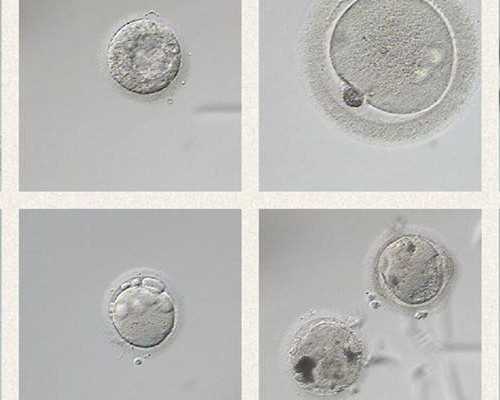 上海试管代怀花销,上海试管医院哪家最好？做试管婴儿还应选择靠谱的医院-上