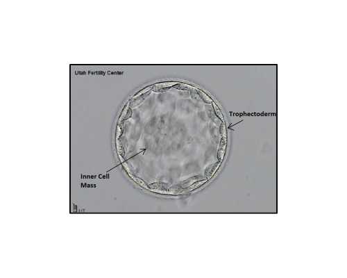 上海供卵自怀费用,上海第一妇婴做试管成功率高吗？