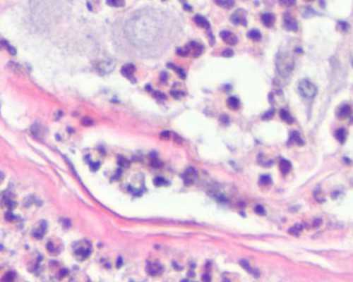 上海代生最便宜,试管婴儿移植后雌二醇和孕酮降低-上海供卵试管生子多少钱