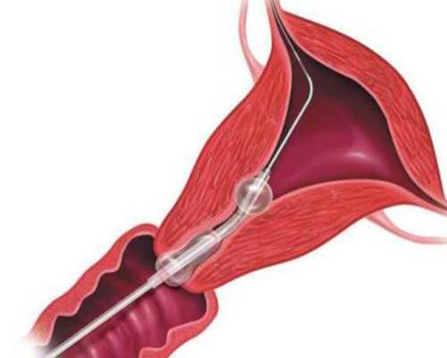 上海代孕包成功套餐,上海第三代试管包生儿子费用明细