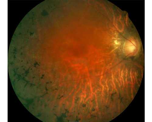 上海代怀网联系方式,泰国没结婚想做试管婴儿_上海供卵试管医院有哪些_试管促