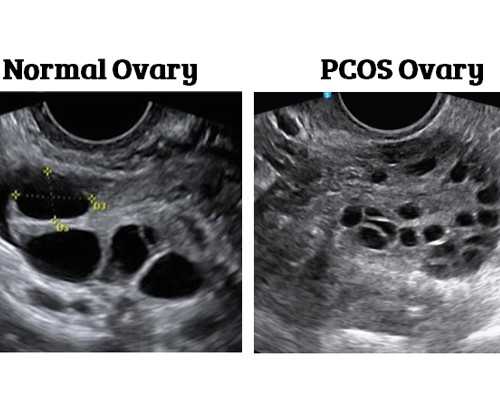 上海找代生生小孩,女人做试管的最佳年龄是多少岁？做试管有年龄限制吗？-上