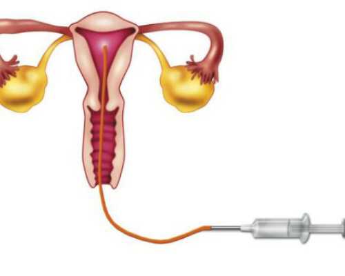 上海代怀在线咨询,上海集爱医院三代试管可以生男女吗？附详细成功率