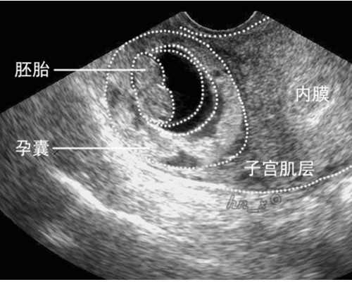 上海供卵费用咨询,如果试管婴儿没有成功的话，以后还可以试着自己自然怀孕
