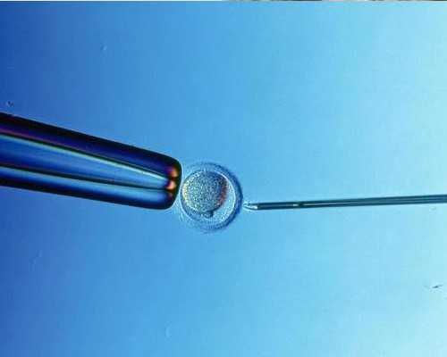 上海代孕生子套餐,试管婴儿移植当天注意些什么_上海供卵试管医院有哪些_专家