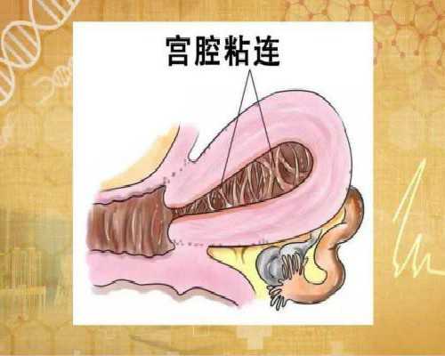 上海六院做一次试管婴儿价格多少？上海第九人民医院做试管婴儿多少钱？