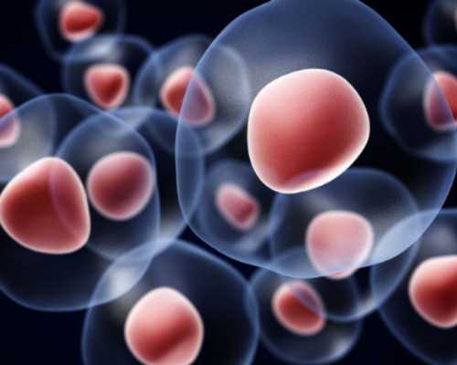 孕妇做NT主要查什么问题？要空腹吗？