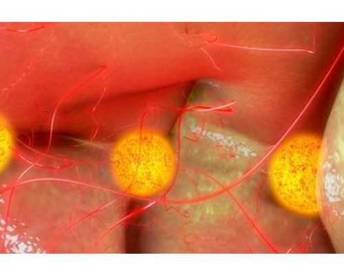 子宫畸形对孩子有影响吗？子宫畸形能生孩子吗？