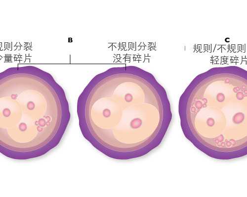 上海召旭医疗科技供卵，旭美