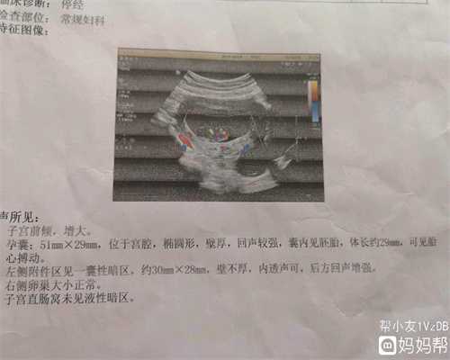 上海哪家代孕公司最好_上海代孕产子公司 西安