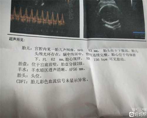 上海代孕女联系方式_qq群代孕_孕37周产检做哪些