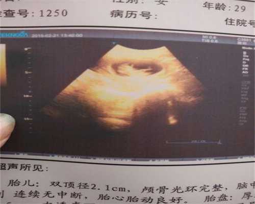 上海添一助孕正规公司吗_上海试管助孕公司地址_宫外孕可能回到宫内么