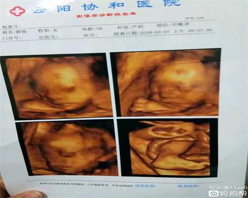上海市不孕不育专家_试管婴儿卵泡多大打夜针_怀孕后可以服用中药补充气血吗