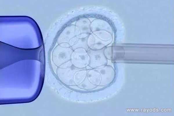 商丘试管婴儿可以借卵吗_商丘借卵子生子医院_AMH检测对美国试管助孕有着重要