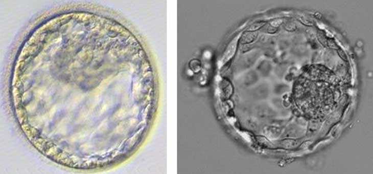 胚胎选择技术提高试管婴儿成功率