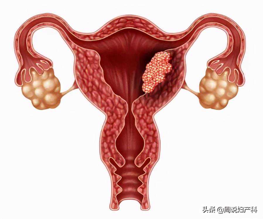 月经期的子宫内膜厚度多少正常