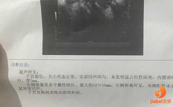 延安代孕方案_延安代孕怎么收费_【广州哪家医院可以做供卵试管婴儿】医生询