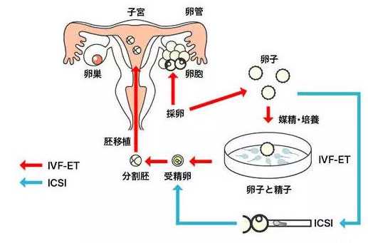 台州有沒有做代孕_台州代孕花钱是多少_试管婴儿怎么诞生的